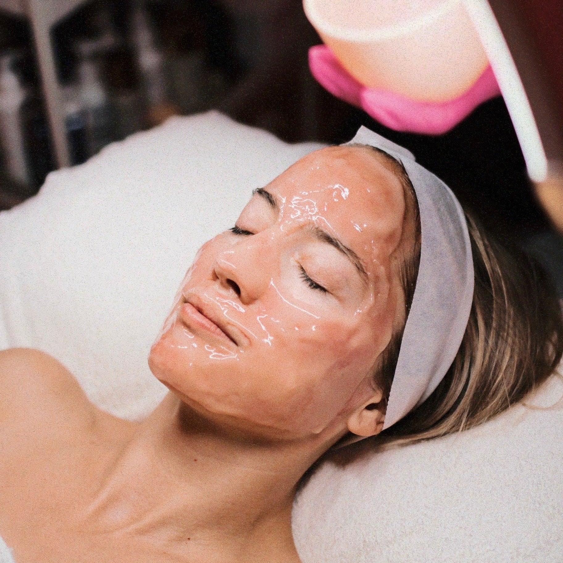 Client with CO2 Lift Pro ask on her face in the treatment room after getting microneedling