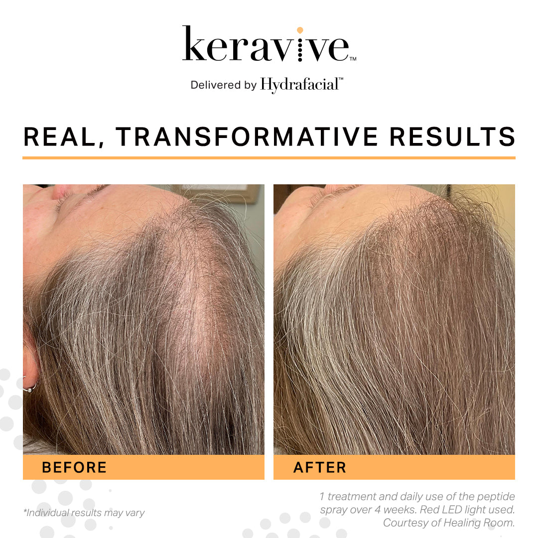 Keravive Peptide Complex Spray - Clover Skin Bar