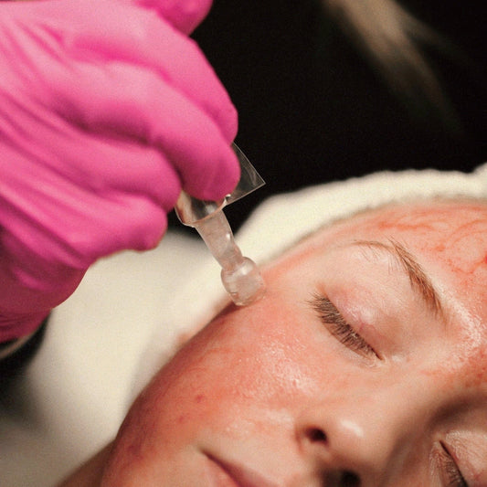 Microneedling Package - Clover Skin Bar