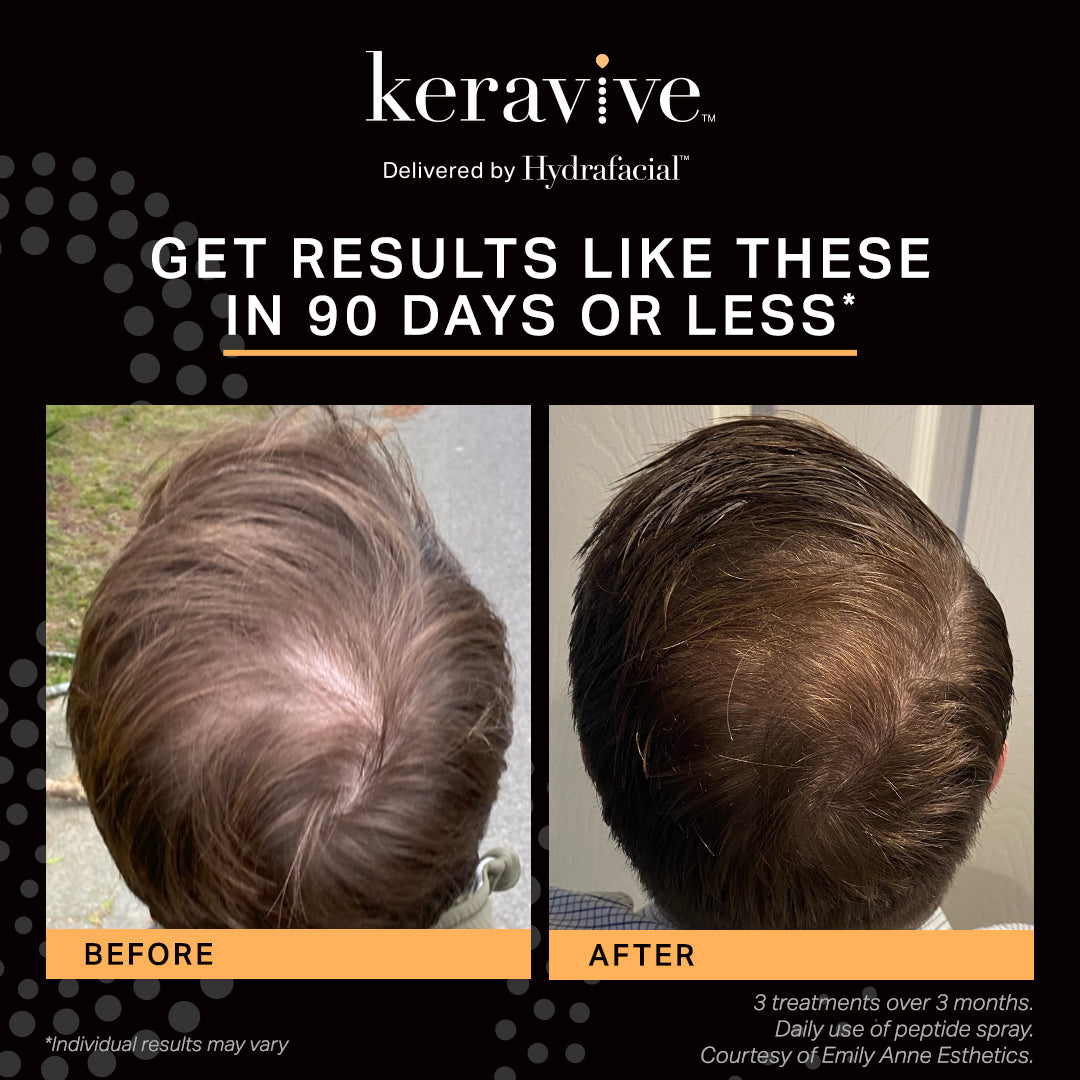 Keravive Peptide Complex Spray