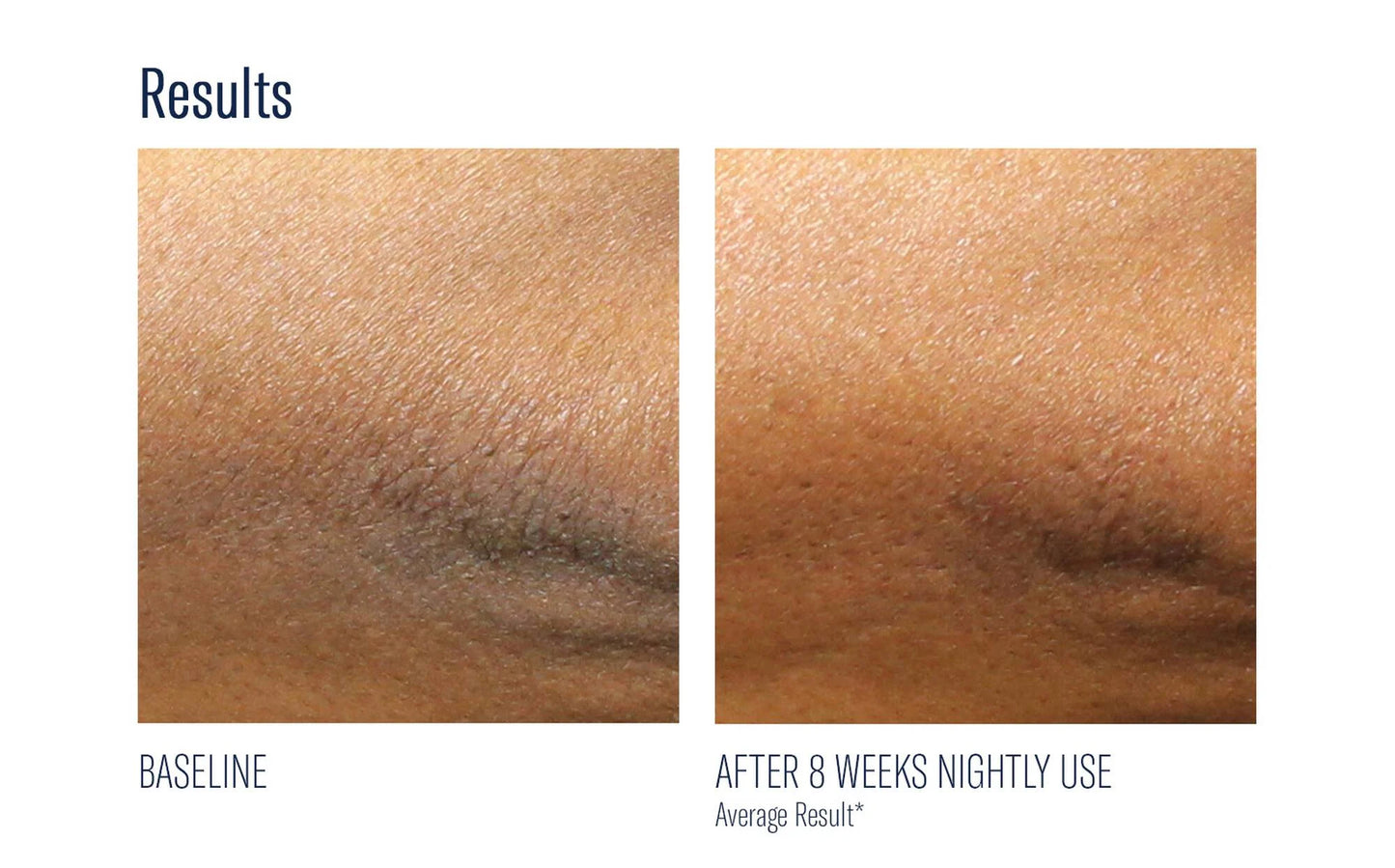 Alpharet Body Overnight Cream - Clover Skin Bar