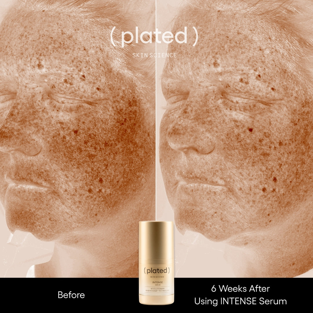 Before and after comparison of plated intense exosome serum