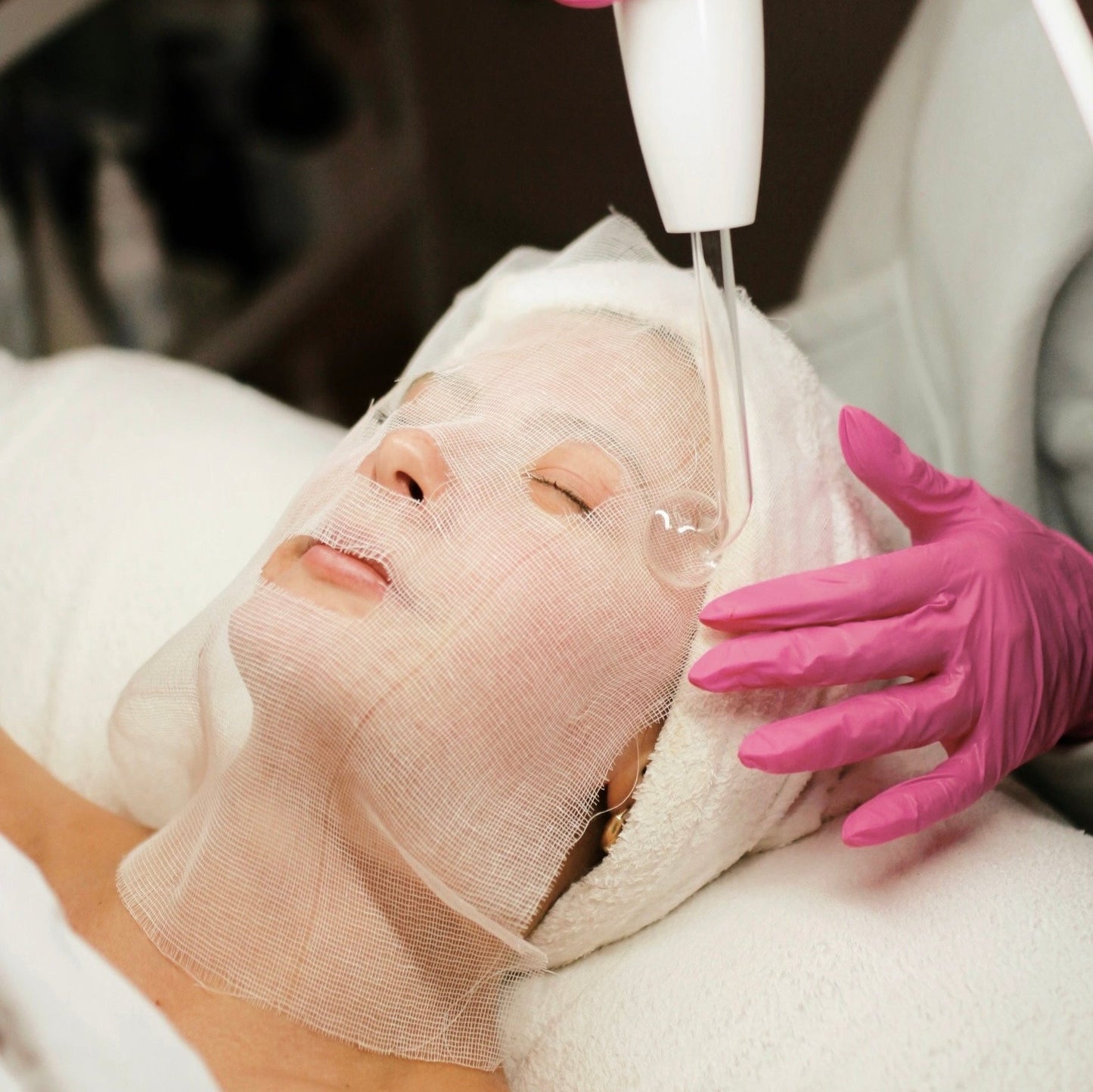 Acne Facial