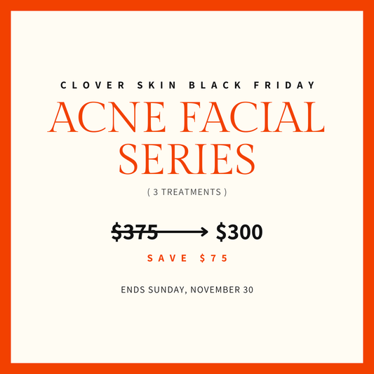 Acne Facial Series - BLACK FRIDAY SALE