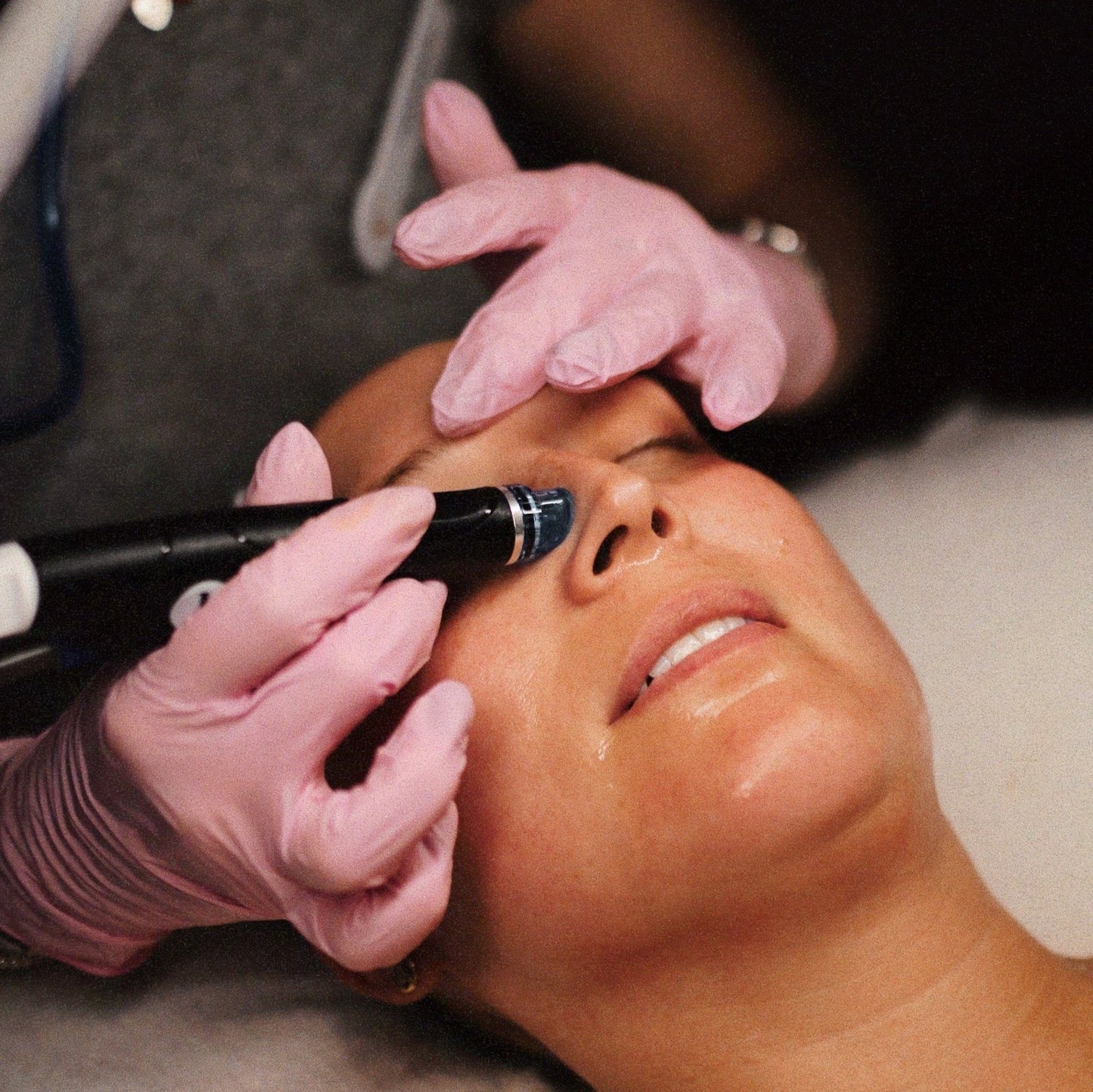 Deluxe Hydrafacial