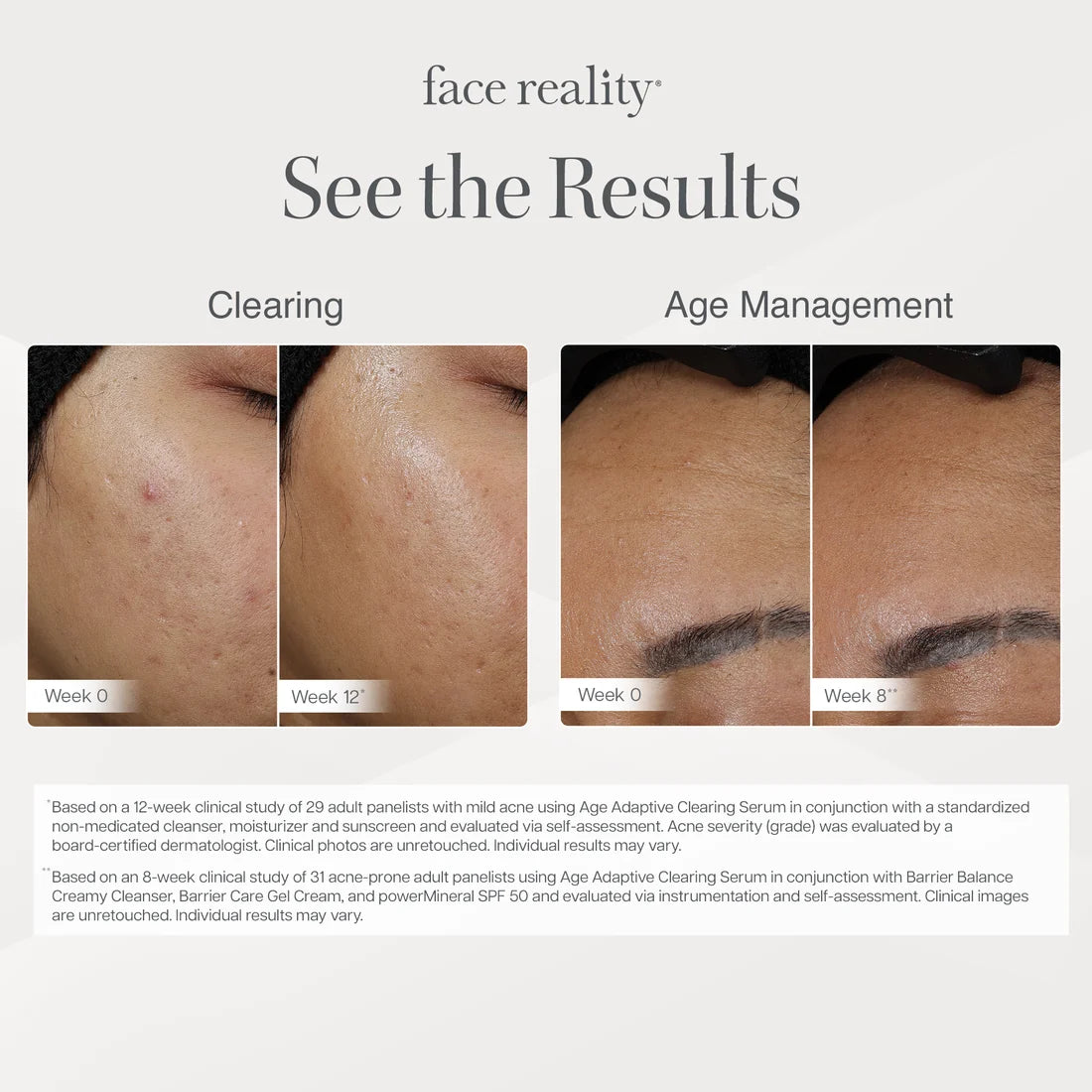 Face Reality Age Adaptive Clearing Serum for sale at Clover Skin Bar. Before and after using the serum.
