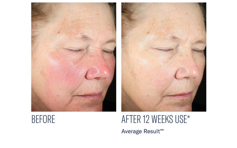 Even Intensive Tone Correcting Serum