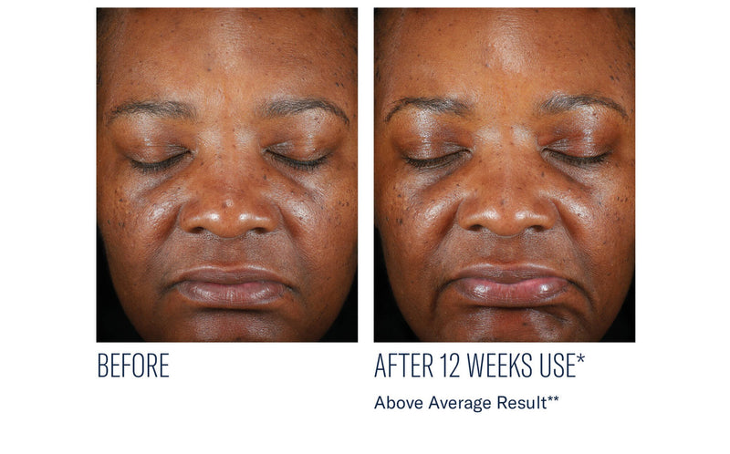 Even Intensive Tone Correcting Serum